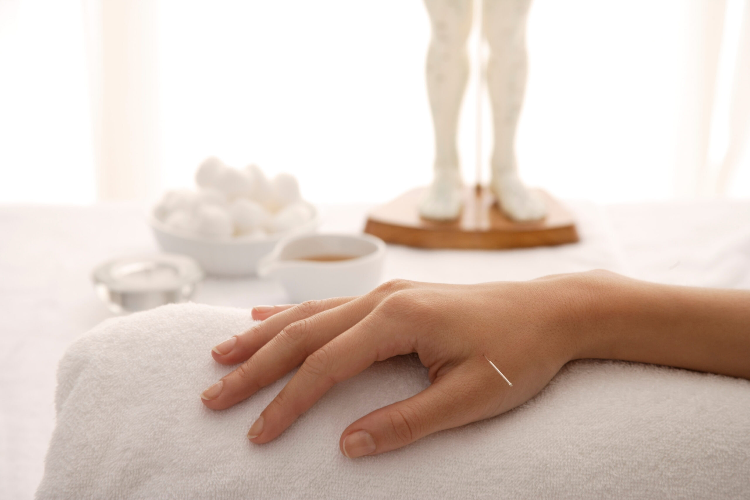 acupuncture needle in woman’s hand